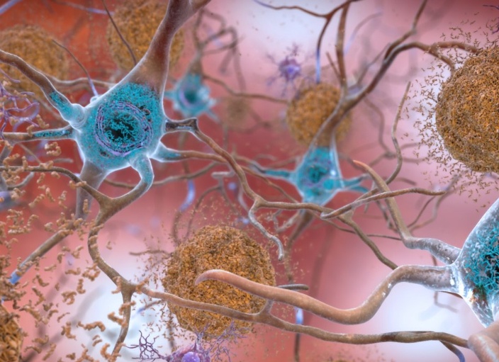 Нейронауки в Science и Nature. Выпуск 226: созданы карты стареющего мозга, основанные на крупнейшей в мире базе данных МРТ