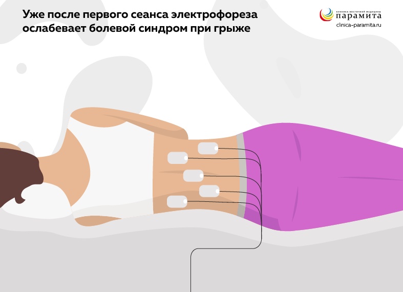 Карипазим и электрофорез при грыже: правда о «чудодейственном лечении», которую скрывают клиники.